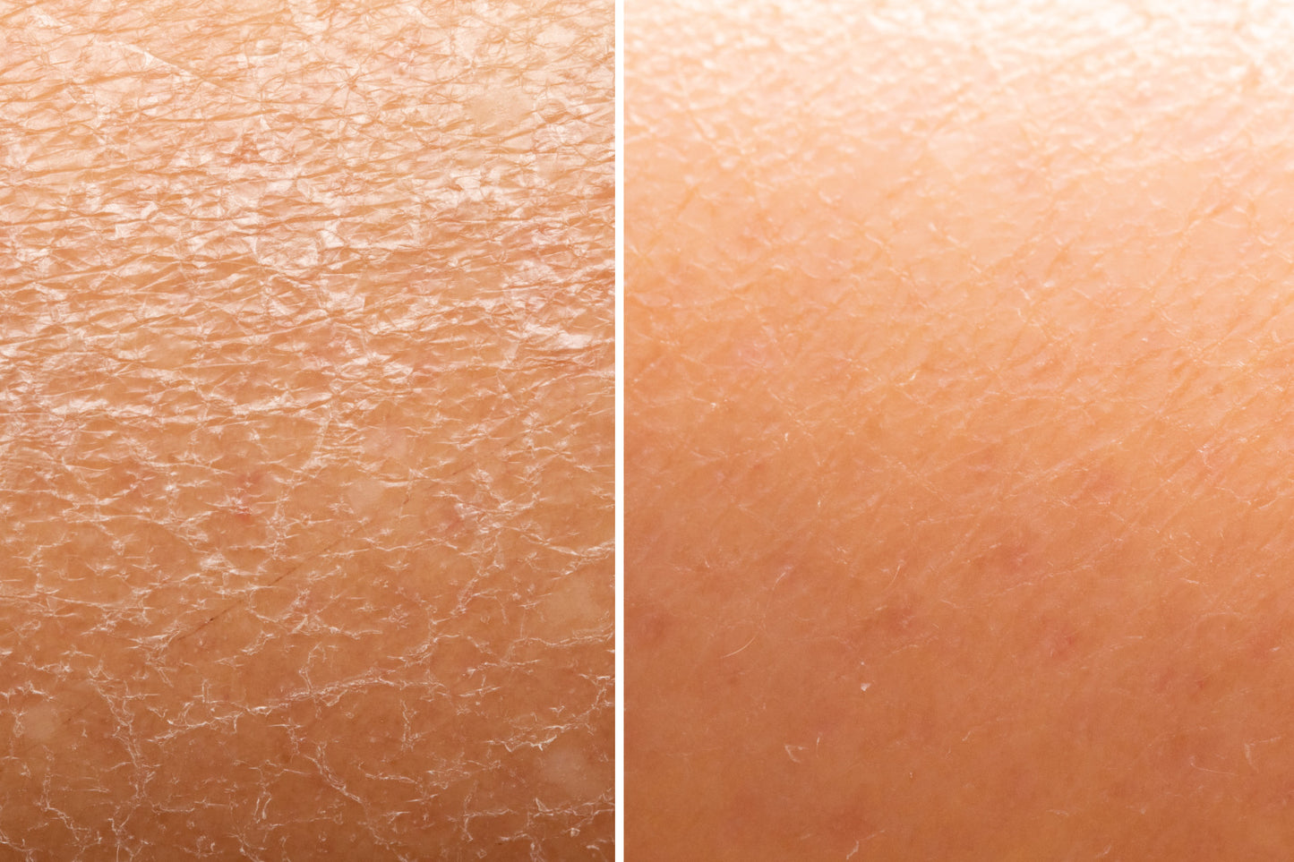 Ultra Hydrating Hyaluronic Acid Gel - 2 oz image 2