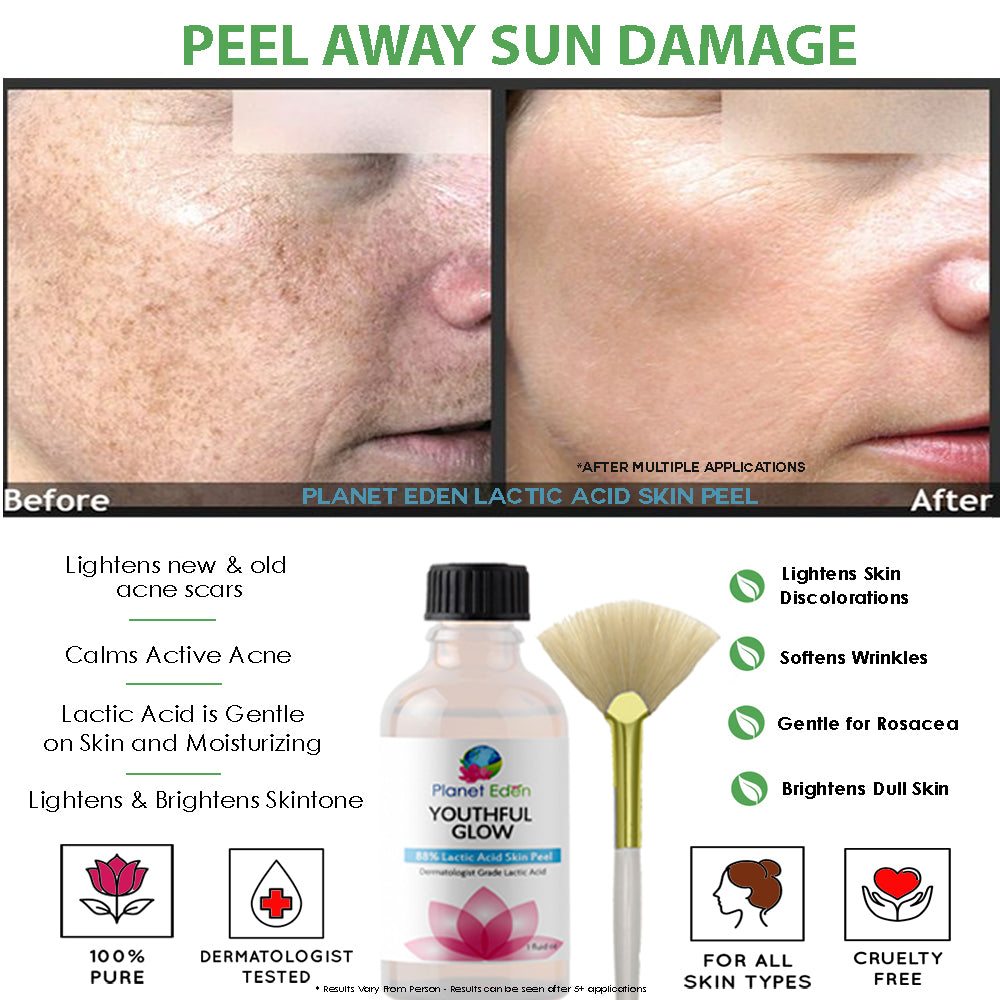 Planet Eden Lactic Acid Skin Peel with Retinol & Hyaluronic Acid Serum Combo image 1